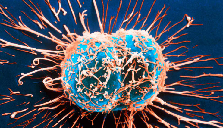 जानें कैसे पता चलेगा कि हमारी रोग प्रतिरोधक क्षमता कमजोर है? coronavirus,corona vaccine,immunocompromised,Health,health news,immune system,poor immune system,symptoms of poor immune system