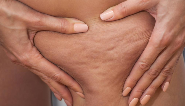 dry brushing benefits,health benefits of dry brushing,dry brushing for skin health,how to dry brush for health,dry brushing for lymphatic drainage,dry brushing for cellulite,best dry brushing techniques,benefits of dry brushing before shower,dry brushing for immune system,dry brushing for natural detoxification