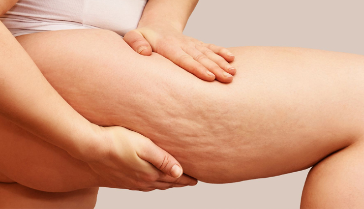 common beauty problems women face,beauty issues for women,skin problems women experience,hair problems for women,beauty struggles women encounter,common skincare concerns,hair care problems,facial skincare issues,acne and pimples in women,dry skin problems,oily skin issues for women,pigmentation problems women face,dandruff issues in women,wrinkles and fine lines,under-eye dark circles,hair thinning in women,skin redness and irritation,uneven skin tone problems,cracked heels and dry feet,body odor issues in women,hair frizz problems,common beauty challenges