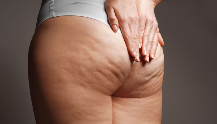 10 Oils You Can Use To Treat Cellulite