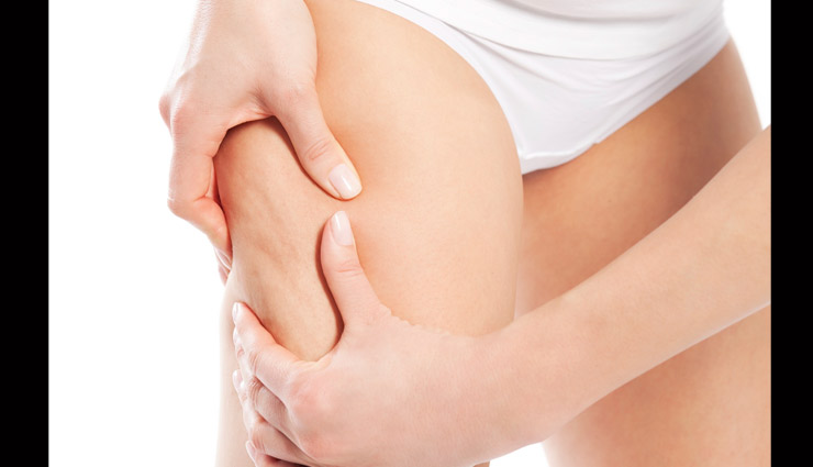 ways to get rid of cellulite from body,remedies to remove cellulite from body,body fitness tips,fitness
