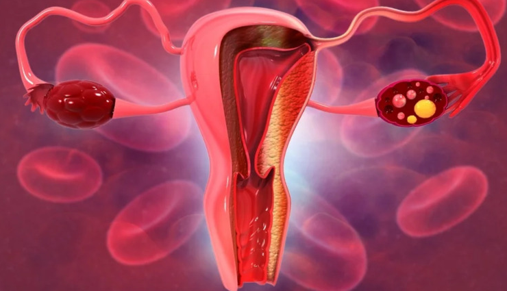 women health,common diseases in women,breast cancer risk,diabetes in women,cervical cancer,arthritis in women,women health precautions