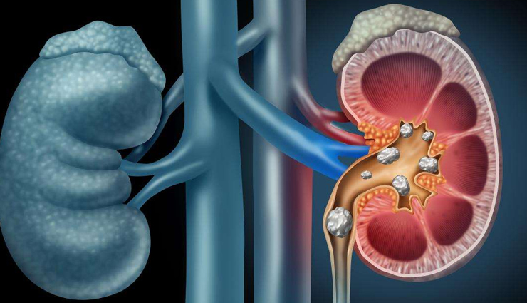 ceylon tea,health benefits of ceylon tea,Health tips,fitness tips