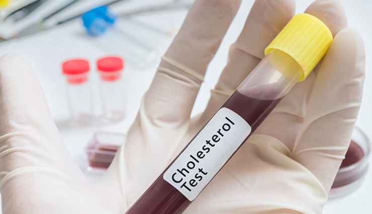 live healthy,medical check ups,dental check up,blood test,cholesterol test,psa test,diabetes test