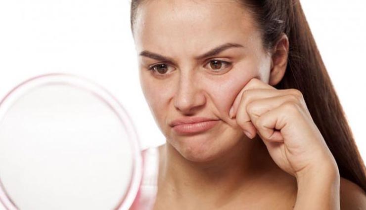 remove spots from face,beauty tips,beauty,simple beauty tips ,चेहरे के दाग कैसे हटाए