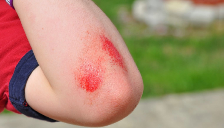 chamomile oil,chamomile oil benefits,chamomile oil beauty benefits,chamomile oil for skin,skin,skin care tips,beauty tips