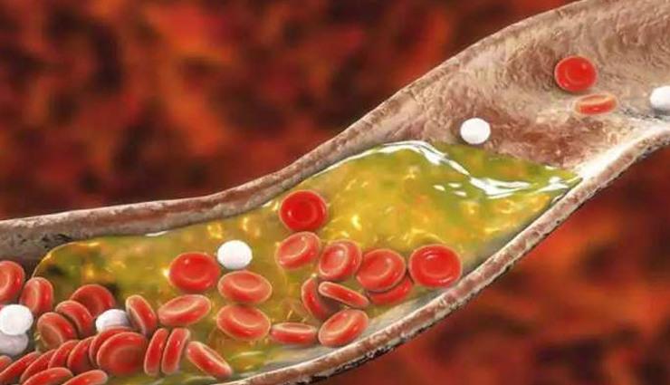 सर्दियों में सेहतमंद साबित होगा पोषण युक्त हरे चने का सेवन, मिलेगा इन शारीरिक समस्याओं में आराम consumption of nutritious green gram will prove to be healthy in winter you will get relief in these physical problems,Health,healthy living