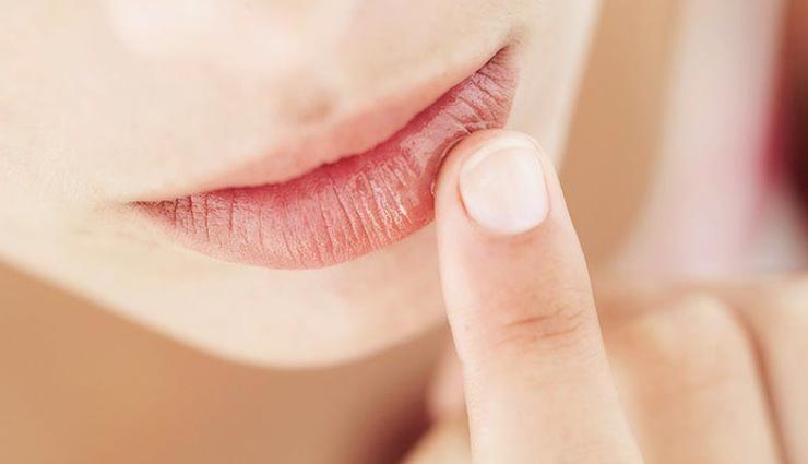 5 Home Remedies To Treat Chapped Lips