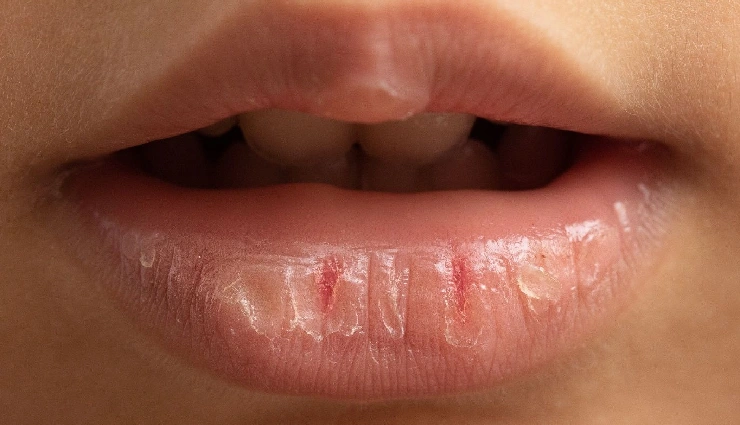 honey for skin,benefits of honey for skin,honey skincare remedies,natural moisturizer honey,honey for glowing skin,acne treatment with honey,home remedies for healthy skin,honey face mask,honey for dry skin,natural skin care ingredients