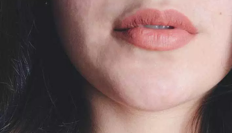 chapped lips,natural remedies,natural remedies for chapped lips,lips care tips,beauty tips,skin care tips,summer tips