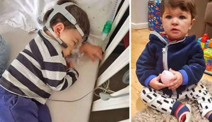 बच्चे की अनोखी बिमारी ने उड़ा दी उसके पेरेंट्स की नींद, पूरी दुनिया में केवल 1 हजार लोगों को यह परेशानी 