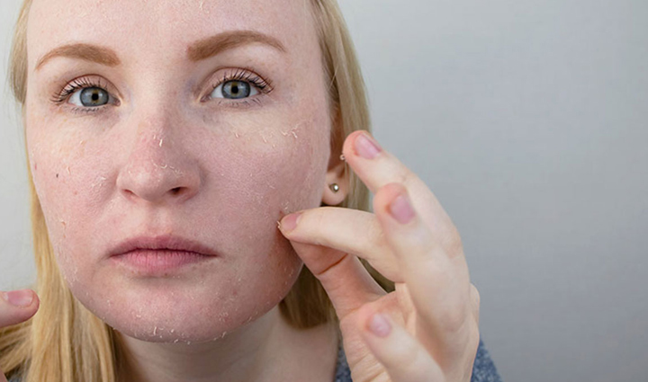 amazing benefits of using cherry,beauty tips,beauty hacks