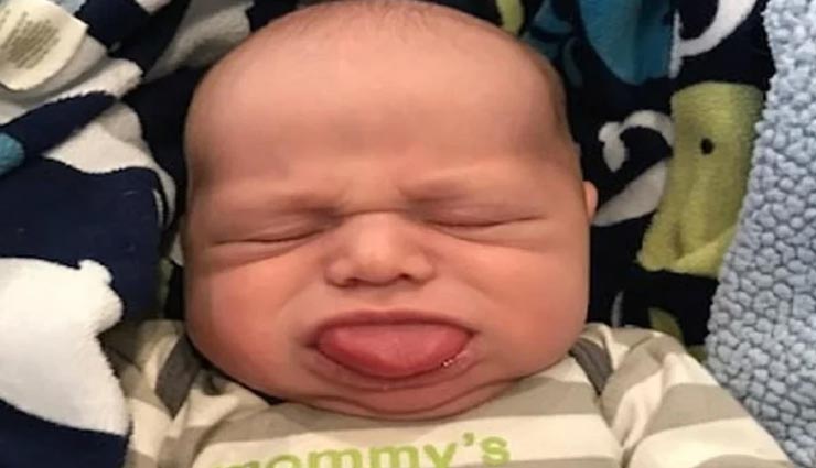 मुंह से चार गुना बड़ी है 3 साल के इस बच्चे की जीभ, सांस लेने में आती हैं दिक्कत