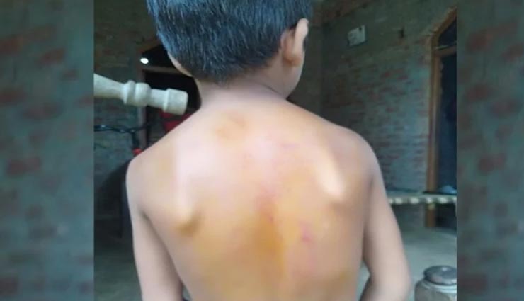 उत्तरप्रदेश : छात्र की शरारत पर शिक्षक को आया गुस्सा, बेरहमी से पिटाई, बच्चे की पीठ हुई लाल