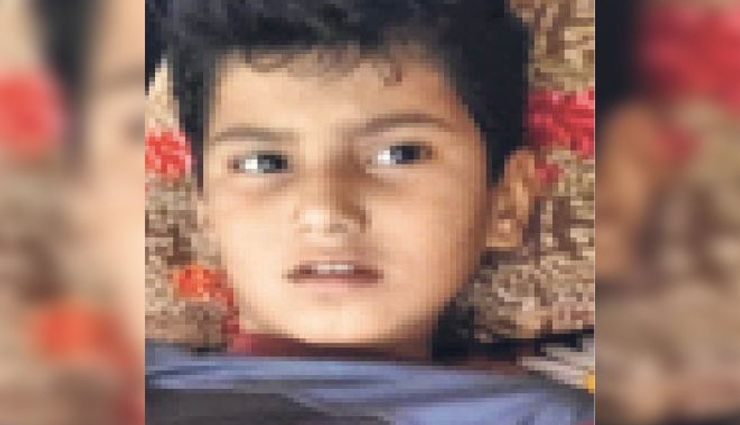 नागौर : पटाखा चलाते समय नादानी पड़ी बच्चे को भारी, जांघ में घुसा स्टील की ग्लास का टुकड़ा, लगे 32 टांके