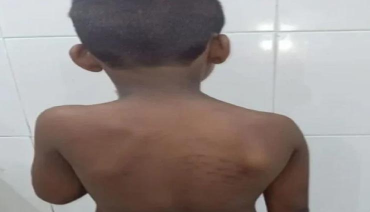 उत्तरप्रदेश : दुकानदार की बेरहमी बच्चों पर पड़ी भारी, टॉफी का पैकेट उठाया तो बेल्ट से पीटा