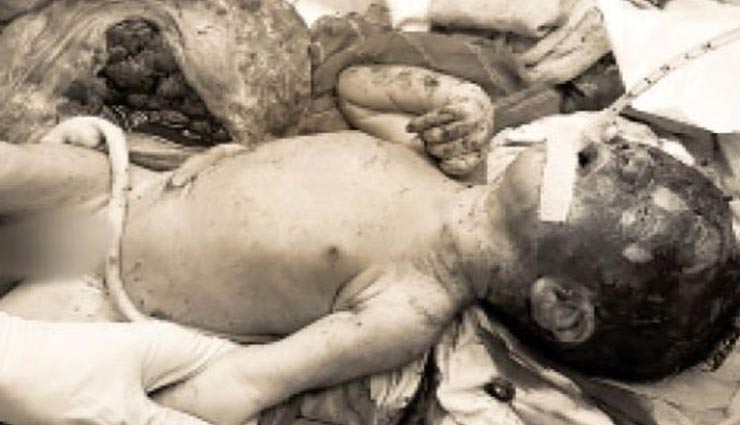 राजस्थान : मानवता का कत्ल करने वाला नजारा, कट्टे में मिले नवजात को नोंच रहे थे कुत्ते, हुई मौत