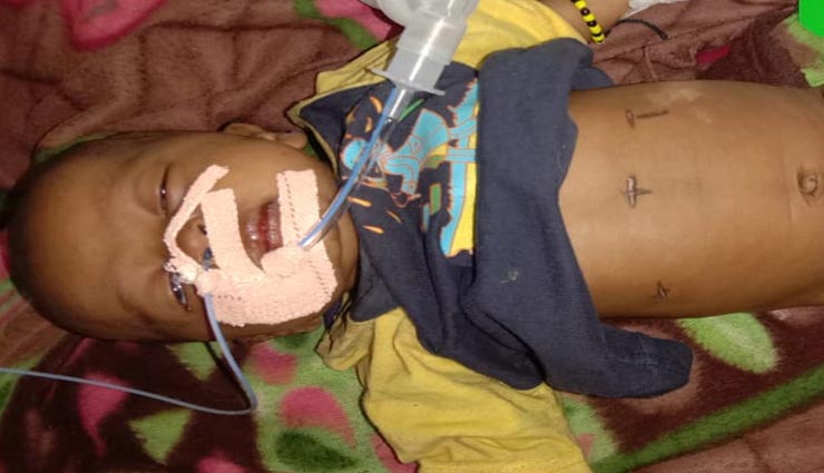 भीलवाड़ा : अंधविश्वास के चलते मासूम के पेट पर गर्म सलाखों से दागा, गई बच्ची की जान