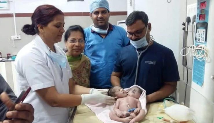 2 सिर और 4 पंजे वाले बच्चे को देख डॉक्टर भी रह गए दंग, मामला मध्यप्रदेश का 