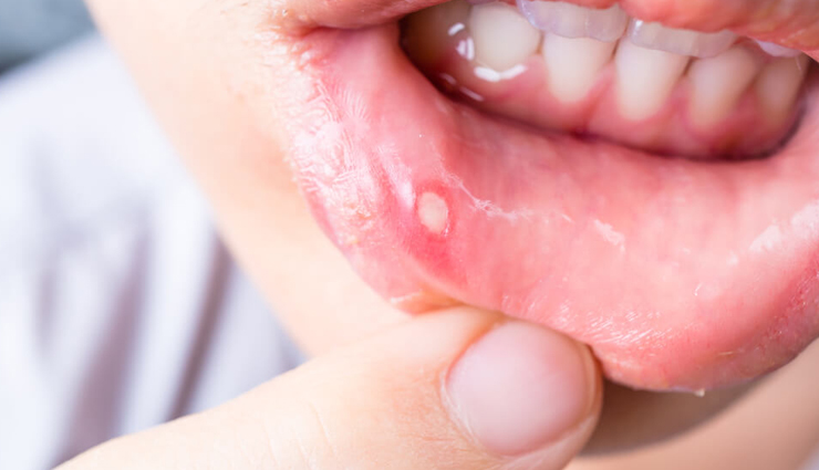 chironji,health benefits of chironji,Health tips,fitness tips