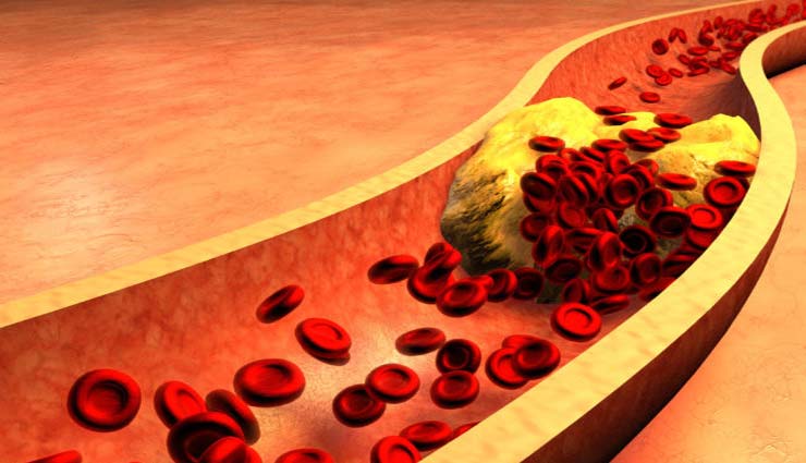 इन 6 तरीकों की मदद से रखे अपने दिल को स्वस्थ और बचे हार्ट अटैक से heart,heart care tips,heart attack,exercise,diet,cholesterol,regular exercise,weight control,Health,heath tips,health tips in hindi