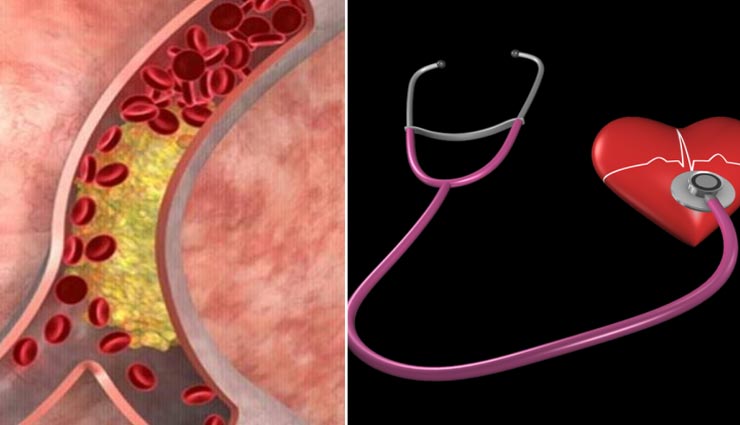 इन 5 चीजों के सेवन से करें बढ़ते कोलेस्ट्रॉल को नियंत्रित, रखें दिल को स्वस्थ