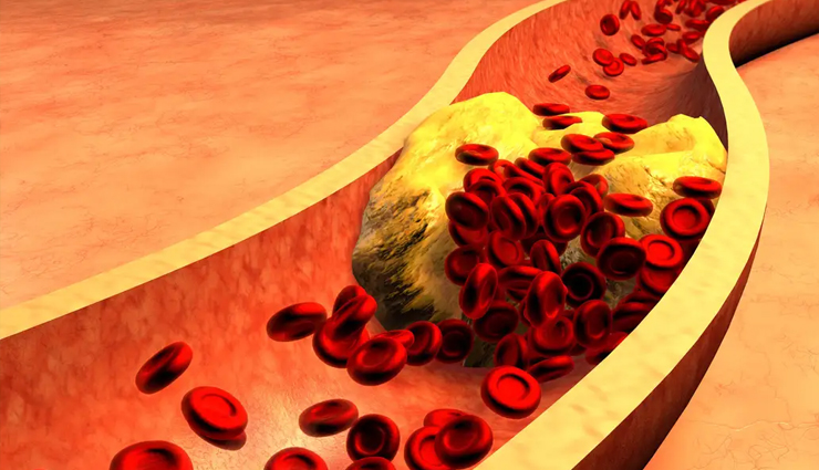 beauty benefits of guava leaves,beauty tips of guava leaves,guava leaves,guava leaves benefits