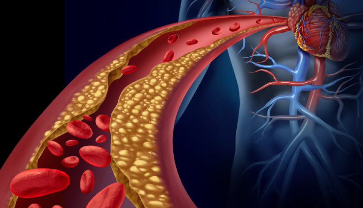 raw onion,raw onion health benefits,healthy food raw onion,raw onion health tips,raw onion for good health,Health tips