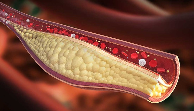 ashwagandha,ashwagandha benefits,ashwagandha health benefits,health benefits of ashwagandha,ashwagandha good for health,Health,healthy living