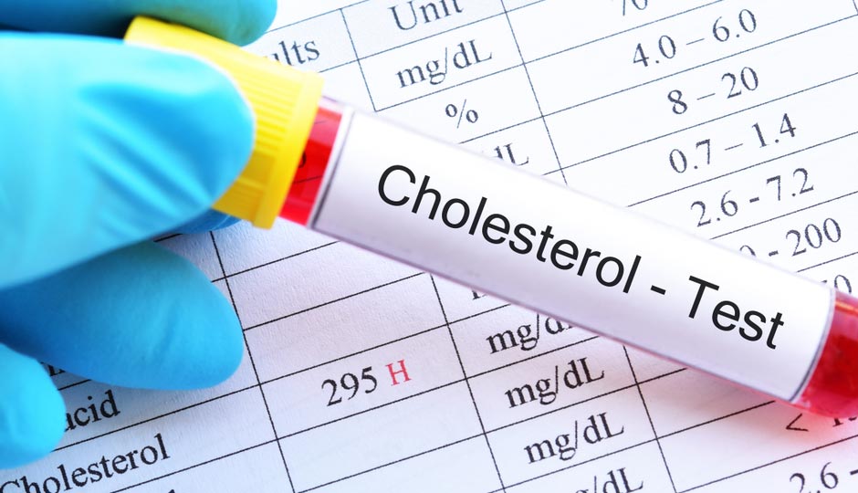 10 Effective Home Remedies To Keep Cholesterol Under Control