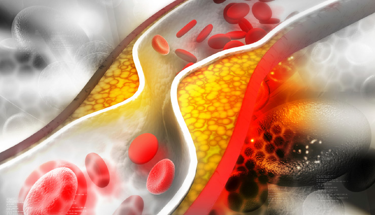 granola,granola health benefits,granola for health,granola healthy food,Health,Health tips