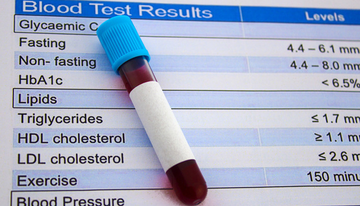 6 Foods That Help You Control Cholesterol Level