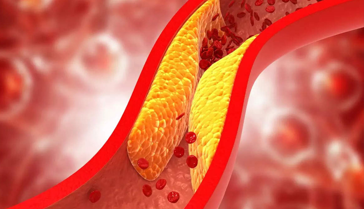 cholesterol,cholesterol level in body,cholesterol level check,cholesterol level in men,cholesterol level in women,health news,healthy living,Health tips