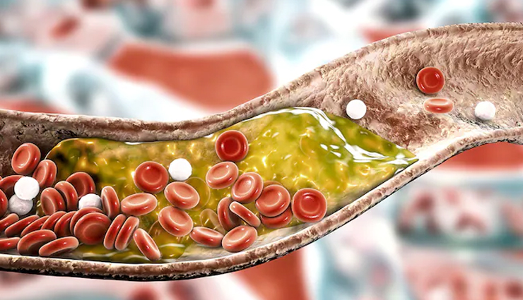 health benefits of flaxseeds,nutritional value of flaxseeds,flaxseeds and their positive impact on health,incorporating flaxseeds in a healthy diet,flaxseeds for heart health,flaxseeds and their role in improving digestion,flaxseeds for weight management,flaxseeds and their potential anti-inflammatory properties,flaxseeds for promoting healthy skin and hair,flaxseeds as a source of omega-3 fatty acids,flaxseeds for regulating blood sugar levels,flaxseeds and their potential cancer-fighting properties,flaxseeds for boosting immunity,flaxseeds and their high fiber content,flaxseeds for hormonal balance