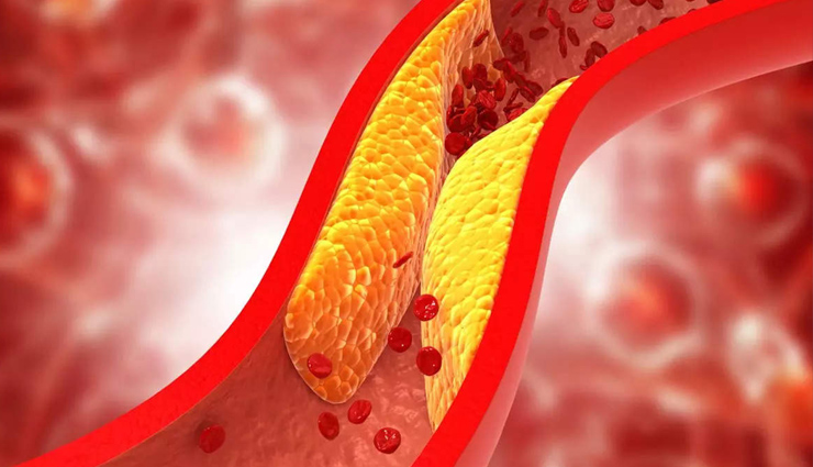 5 Foods That Will Help To Reduce Bad Cholesterol
