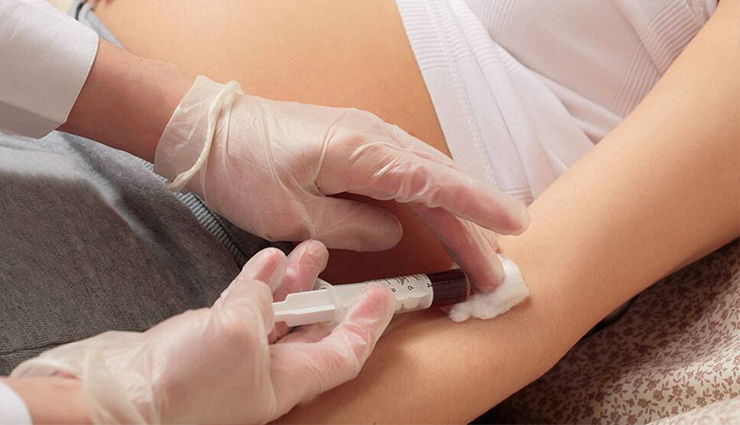 ginger,ginger for health,healthy food ginger,ginger for good health,health benefits of ginger,healthy food ginger benefits,Health,Health tips