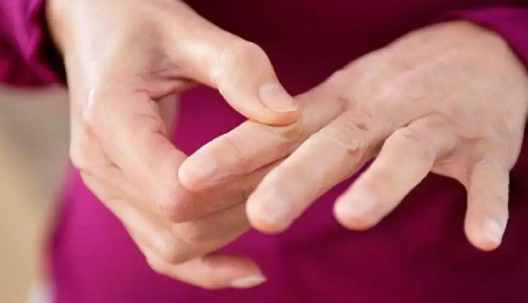 कोलेस्ट्रॉल जब बढ़ जाए हद से ज्यादा तो हाथों-पैरों की उंगलियों पर दिखते हैं ये लक्षण, नजरअंदाज करना पड़ सकता है महंगा