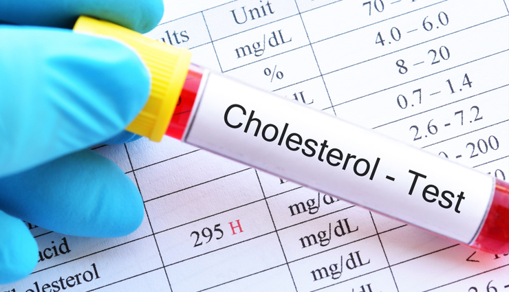 5 Remedies That Will Help To Reduce your Cholesterol Level Naturally