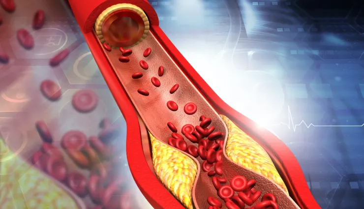 health benefits of garlic,healthy living,Health tips