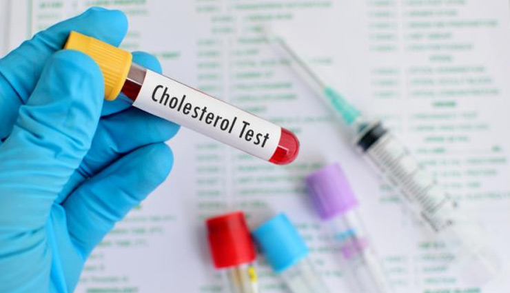ldl cholesterol,ldl cholesterol is necessary,low ldl cholesterol may cause stroke,Health,health news in hindi