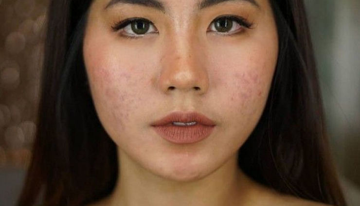 cilantro,beauty benefits of cilantro,cilantro for skin,skin care tips,beauty tips