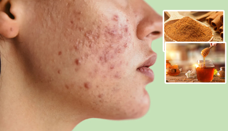 diy face masks,homemade face masks,natural face masks,2 ingredient face masks,glowing skin,healthy skin,skin care,beauty tips,skin problems,blackheads,oily skin,acne,aging,skin tightening,deep cleaning pores,clear skin,brighten skin,reduce dark spots,hydrate skin,exfoliate skin