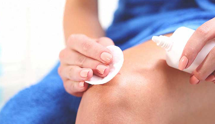 boils,natural way to treat boil,treat boil at home,boil treatment,home remedies to treat boil