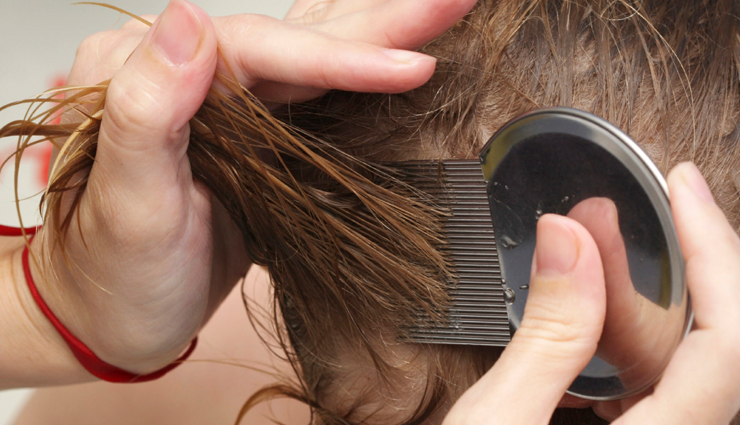 head lice,home remedies to get rid of head lice,lice problem,scalp care tips,scalp care,beauty,beauty tips