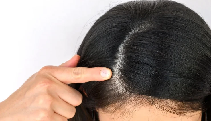 orange benefits for hair,orange peel for hair,vitamin c for hair,natural hair conditioner,reduce hair fall,dandruff remedies,orange hair mask,fruit for healthy hair,hair shine tips,hair care with oranges