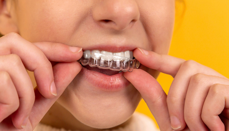 clear aligners facts,dental facts about clear aligners,clear aligners information,facts on teeth alignment,benefits of clear aligners,understanding clear aligners,clear aligners for dental correction,key points about clear aligners,clear aligners for teeth straightening,insights on clear aligners for oral care,teeth straightening with clear aligners,clear aligners versus traditional braces,clear aligners for orthodontic correction,advantages of using clear aligners,clear aligners for dental realignment,clear aligners for a perfect smile,dental health with clear aligners,invisible braces for teeth alignment,clear aligners benefits and drawbacks,clear aligners technology in dentistry