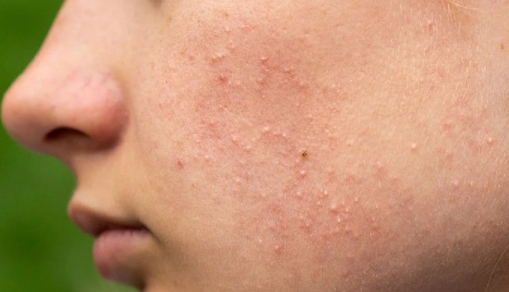 daily makeup use,foundation side effects,makeup addiction,effects of using foundation daily,skin issues from makeup,daily makeup routine,makeup and self-confidence,long-term effects of foundation,foundation makeup pros and cons,beauty habits and skin health