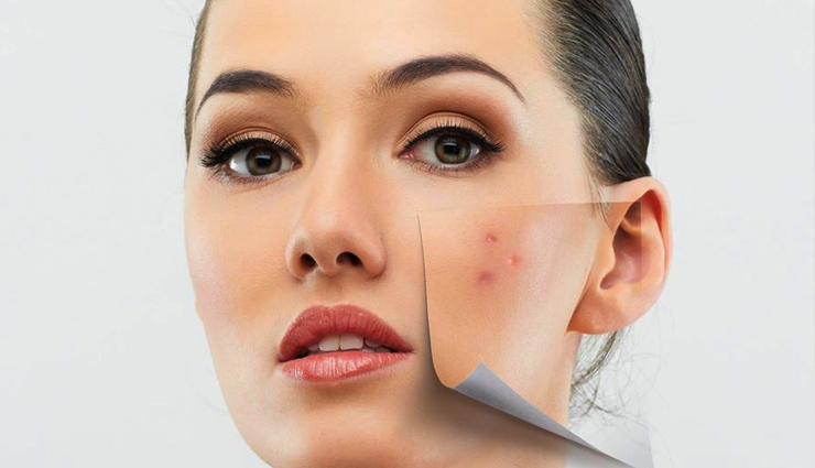 7 Wrong Habits That Causes Clogged Skin Pores
