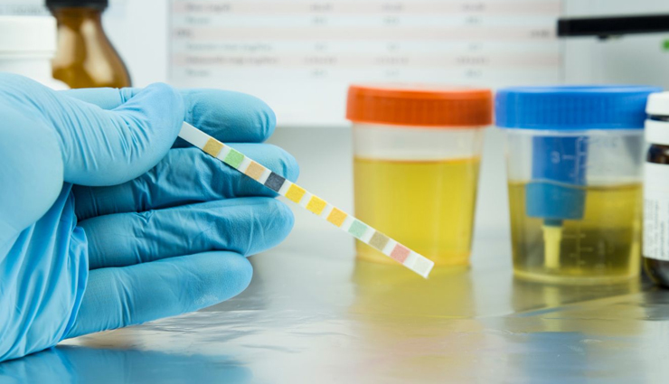 home remedies for cloudy urine,natural ways to clear cloudy urine,cloudy urine remedies at home,diy solutions for cloudy urine,what causes cloudy urine?,how to prevent cloudy urine,clearing cloudy urine naturally,understanding cloudy urine symptoms,natural remedies for urinary tract health,foods that clear cloudy urine,herbal remedies for urinary issues,promoting urinary health naturally,importance of hydration for clear urine,drinking water to prevent cloudy urine,hydration and urinary health,how water affects urine clarity,cloudy urine and kidney health,urinary infections and cloudy urine,cloudy urine and dehydration,medical conditions associated with cloudy urine,lemon water for cloudy urine,cranberry juice for urinary health,baking soda remedies for cloudy urine,apple cider vinegar for urinary issues