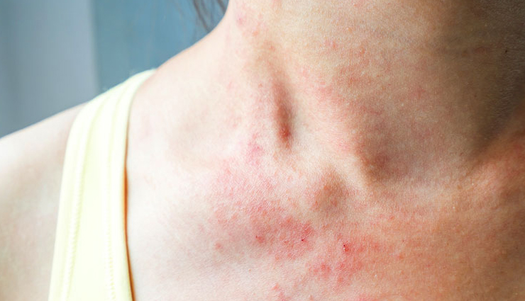 clove oil,health benefits of clove oil,Health tips,fitness tips